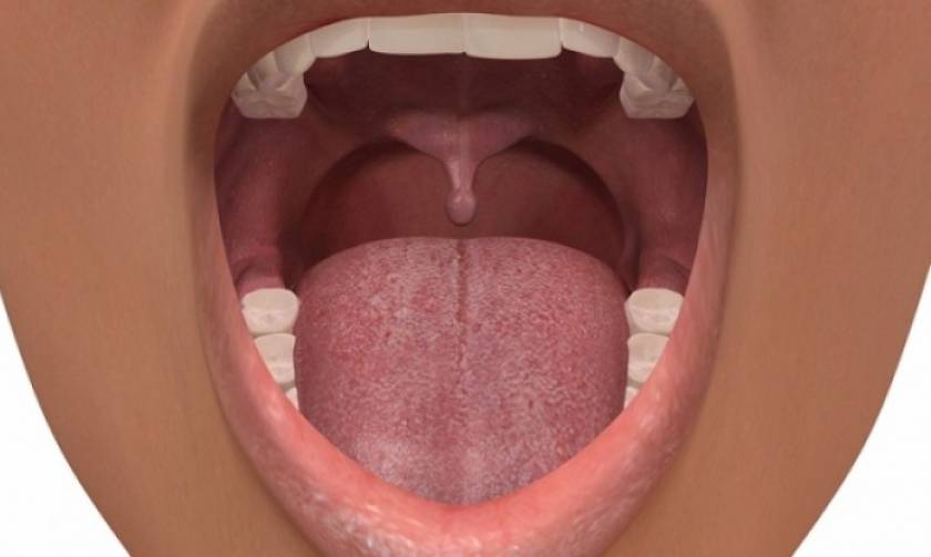 Σιαλολιθίαση: Η επίπονη πάθηση του στόματος - Ποια είναι τα συμπτώματα