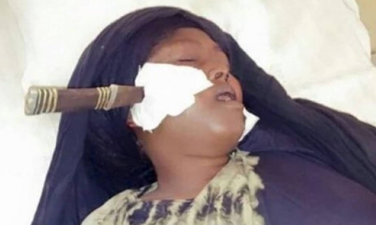 Κένυα: Αδίστακτος σύζυγος κάρφωσε στο πρόσωπο την γυναίκα του (pics)