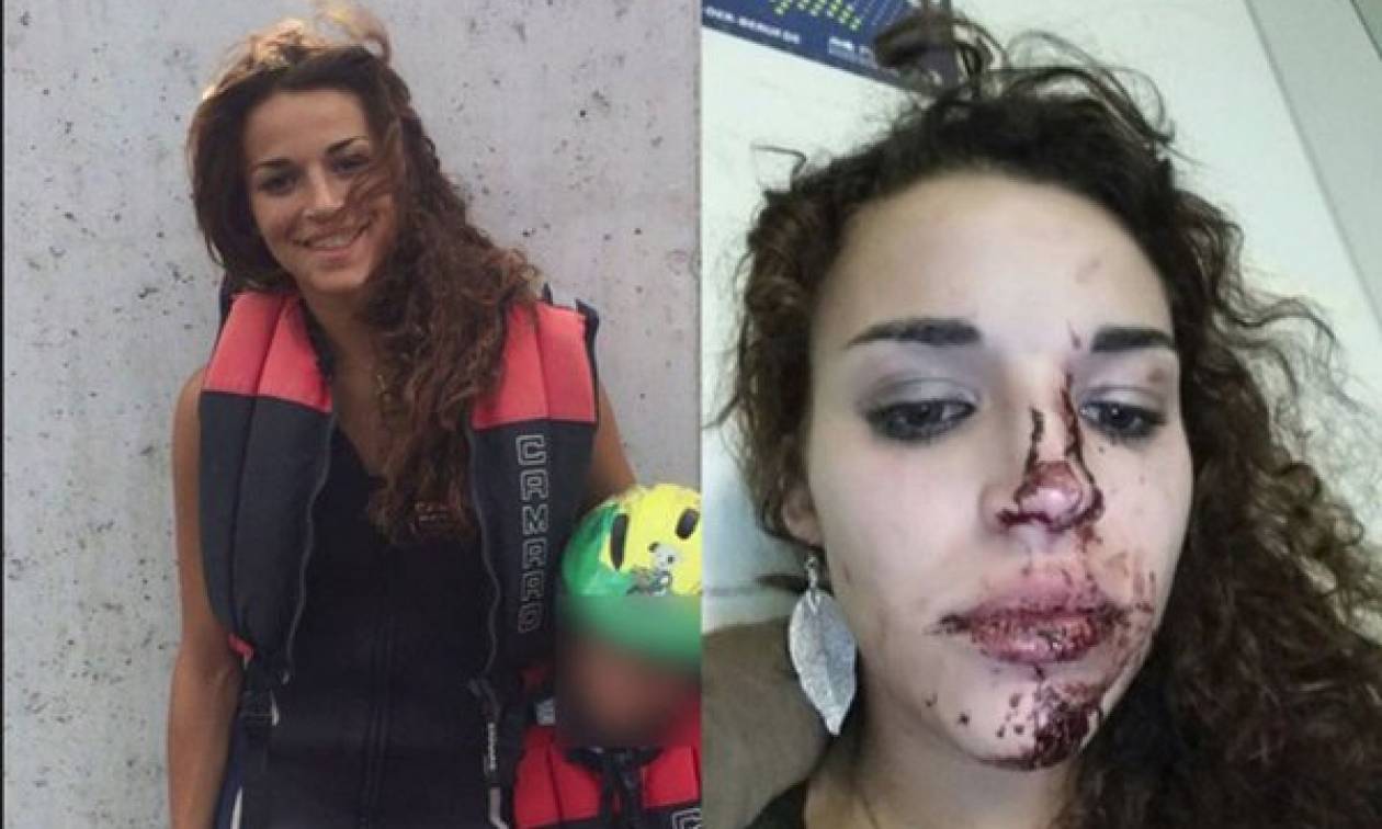 Κολωνία: Δημοσιεύματα υποστηρίζουν ότι «φωτογραφίες-σοκ» γυναικών που δέχτηκαν επίθεση είναι πλαστές
