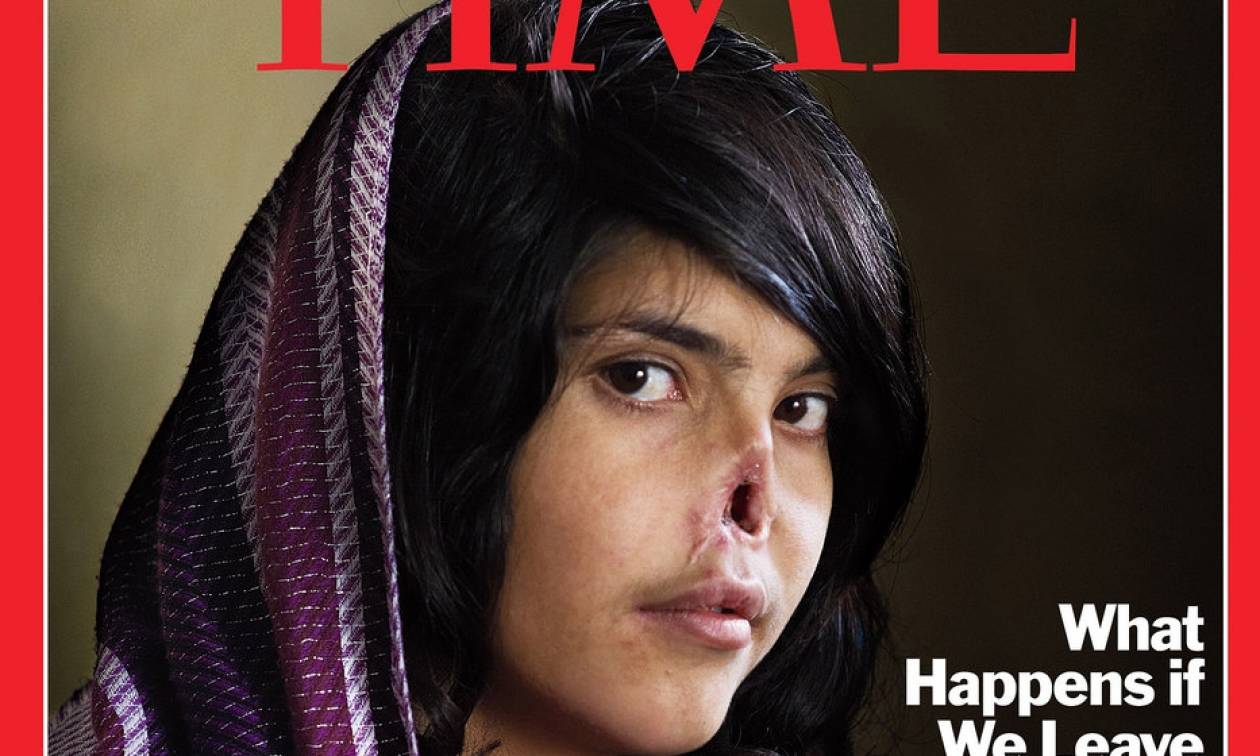 Φρίκη στο Αφγανιστάν: Έκοψε τη μύτη της 20χρονης συζύγου του (photo)