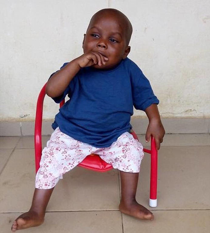 Και όμως υπάρχει ελπίδα: Το θαύμα της μεταμόρφωσης του αγοριού που βρέθηκε υποσιτισμένο στη Νιγηρία 