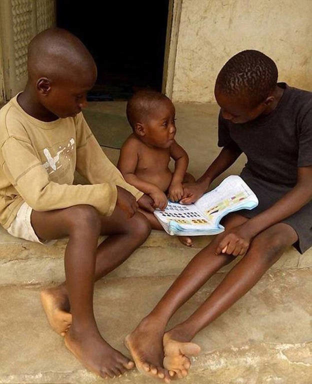 Και όμως υπάρχει ελπίδα: Το θαύμα της μεταμόρφωσης του αγοριού που βρέθηκε υποσιτισμένο στη Νιγηρία 