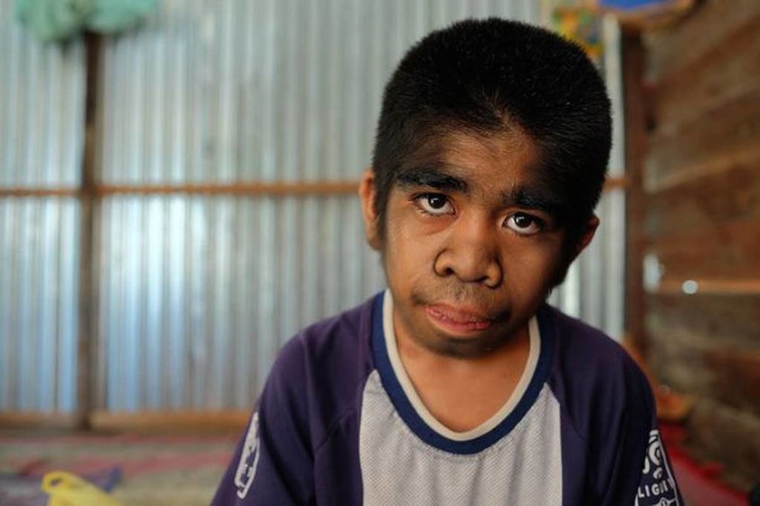 Αγόρι… λυκάνθρωπος λατρεύεται ως Θεός στην Ινδονησία (video+photos)