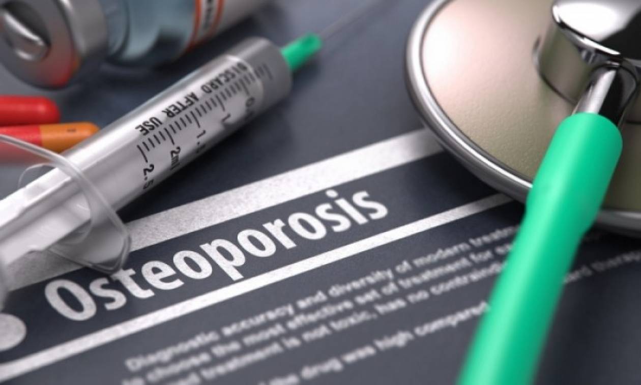 Οστεοπόρωση: Ο ρόλος της φαρμακευτικής αγωγής και πότε μπορεί να διακοπεί