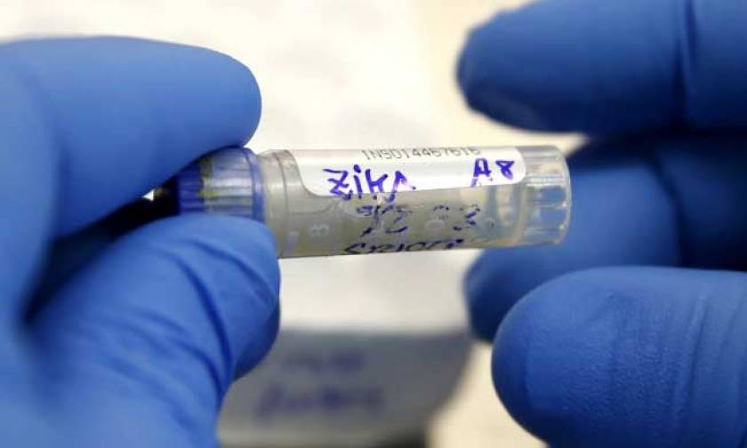 Ερευνητές ανακάλυψαν αντισώματα που εξουδετερώνουν τον ιό Ζίκα