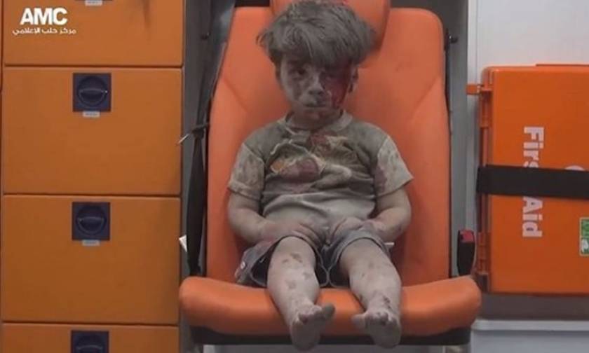 Συρία: Ξεψύχησε ο 10χρονος αδελφός του μικρού Ομράν που έγινε σύμβολο της αγριότητας του πολέμου