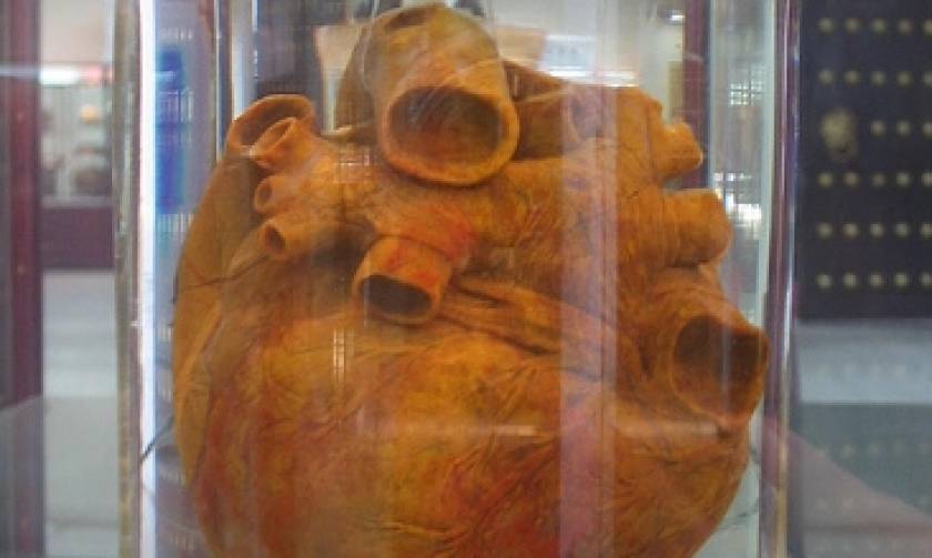 Φρικιαστικό: Ανακάλυψαν ανεξήγητα καλοδιατηρημένη καρδιά και 45 εγκεφάλους (video+photos)