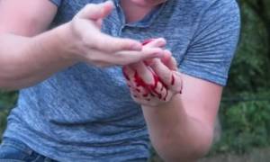 Βίντεο σοκ: Διάσημος σταρ έκανε το... νίντζα και έκοψε το δάχτυλό του! (video)
