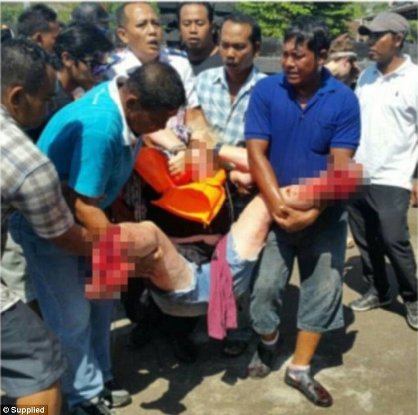 ΕΚΤΑΚΤΟ: Ισχυρή έκρηξη σε φέρι με τουρίστες στο Μπαλί – Τουλάχιστον δύο νεκροί (ΣΚΛΗΡΕΣ ΕΙΚΟΝΕΣ)