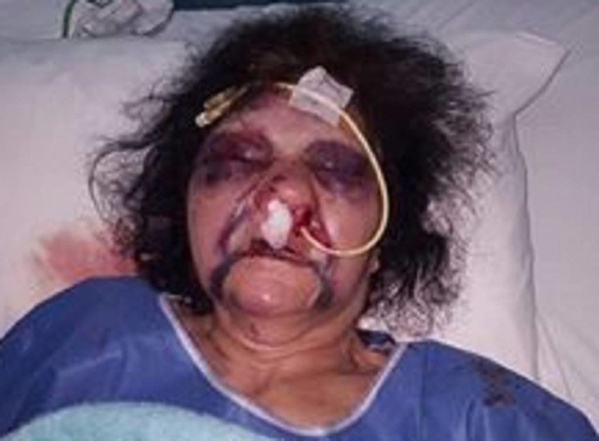 Εικόνα – σοκ: Χτύπησαν άγρια γυναίκα στη Ρόδο (pic)