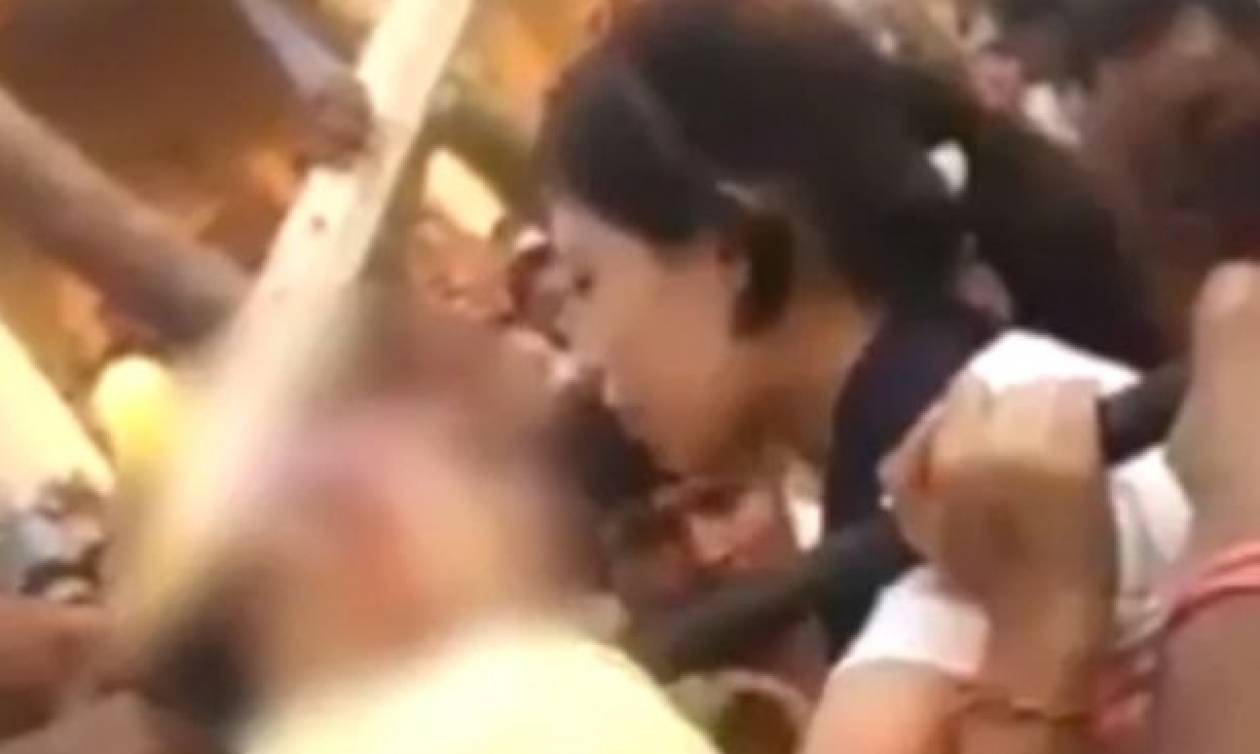Το πιο φρικιαστικό ατύχημα: Ρόδα λούνα παρκ τής ξερίζωσε το σκαλπ για μία selfie (σκληρό βίντεο)