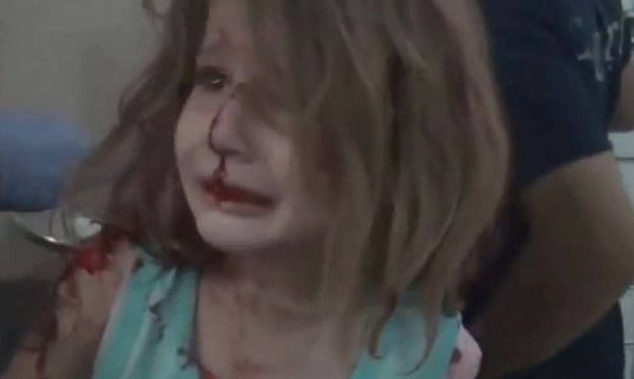 Συγκλονιστικές εικόνες από τη Συρία: Τραυματισμένο κοριτσάκι ψάχνει τον πατέρα της (vid)