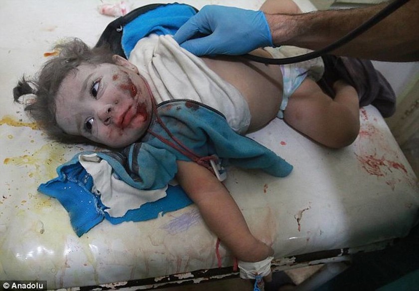 Εικόνες φρίκης στη Συρία: Πρελούδιο θανάτου για χιλιάδες αθώα παιδιά (ΠΡΟΣΟΧΗ! ΣΚΛΗΡΕΣ ΕΙΚΟΝΕΣ!)