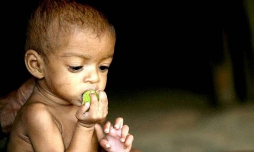 Yποσιτισμένα πέντε στα έξι βρέφη σε αναπτυσσόμενες χώρες