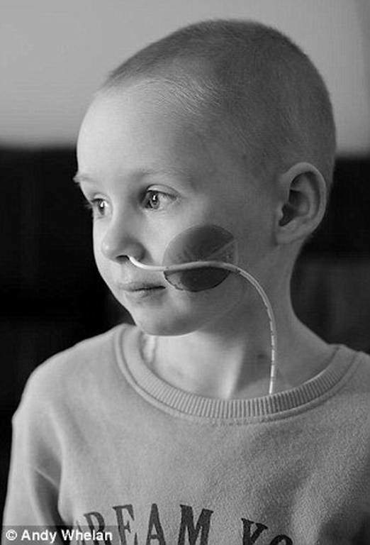 Πέθανε το αγγελούδι που ράγισε την καρδιά του κόσμου δείχνοντας το πρόσωπο του παιδικού καρκίνου