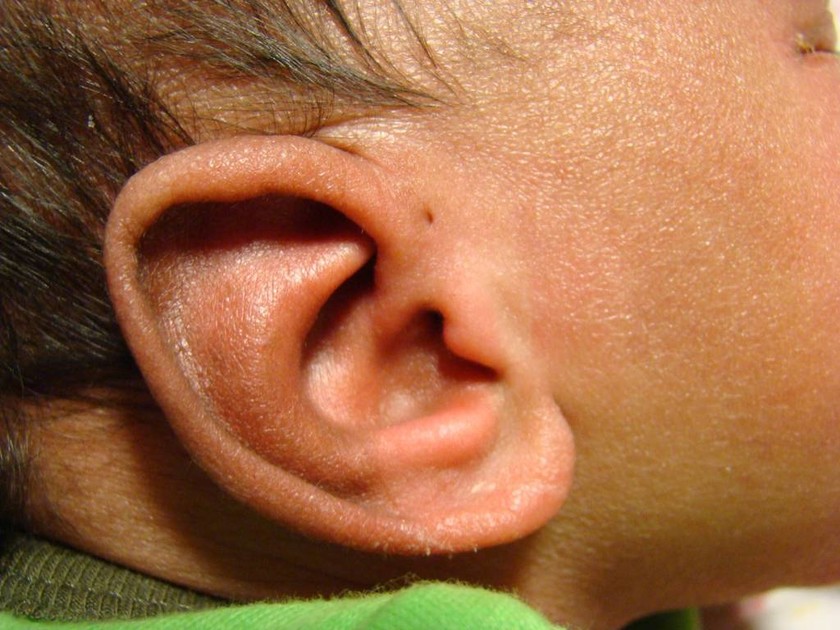 Εσύ ξέρεις τι σημαίνει αυτή η τρύπα στα αυτιά μερικών ανθρώπων; Μόλις μάθετε θα ανατριχιάσετε