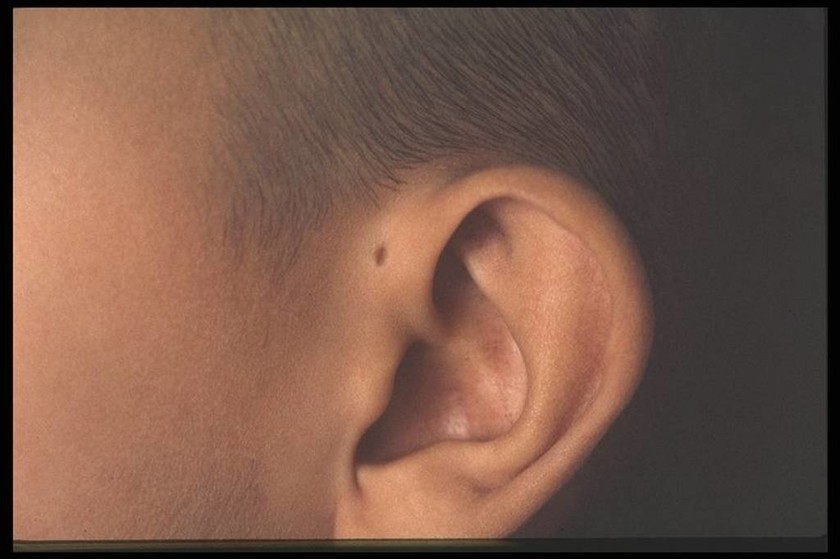 Εσύ ξέρεις τι σημαίνει αυτή η τρύπα στα αυτιά μερικών ανθρώπων; Μόλις μάθετε θα ανατριχιάσετε