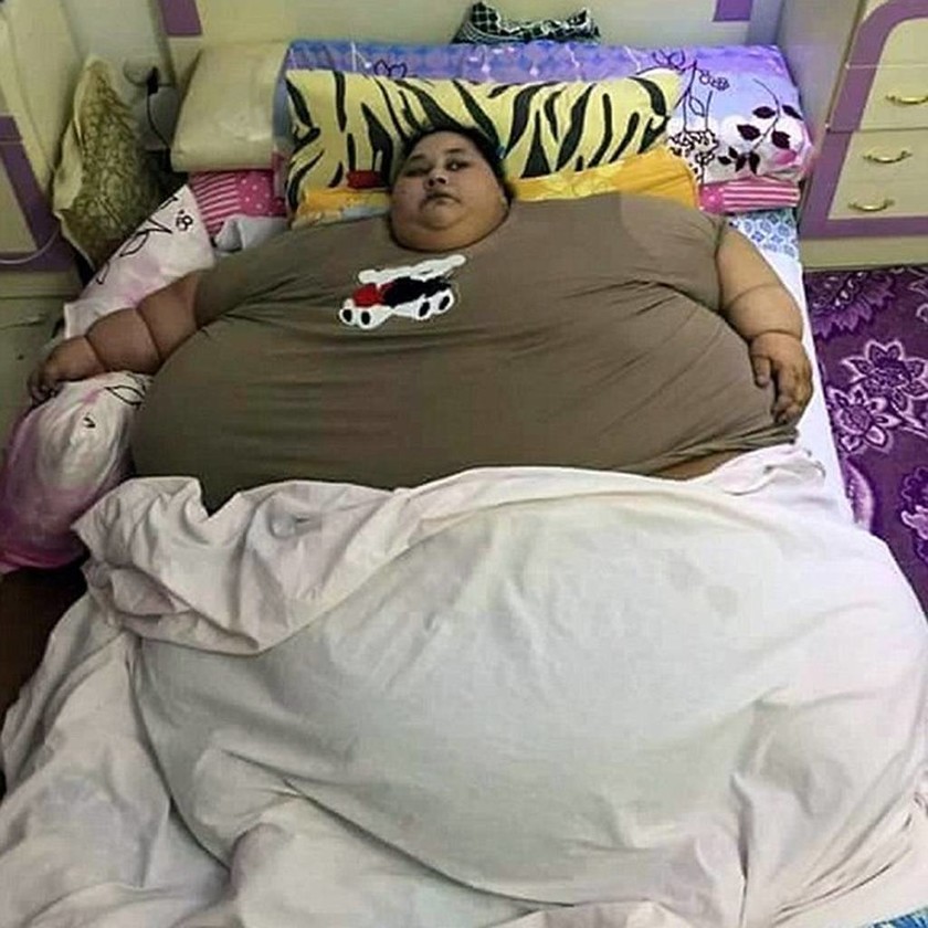 Η πιο υπέρβαρη γυναίκα στον κόσμο ζυγίζει 500 κιλά - Θα χειρουργηθεί για να χάσει βάρος (pics)