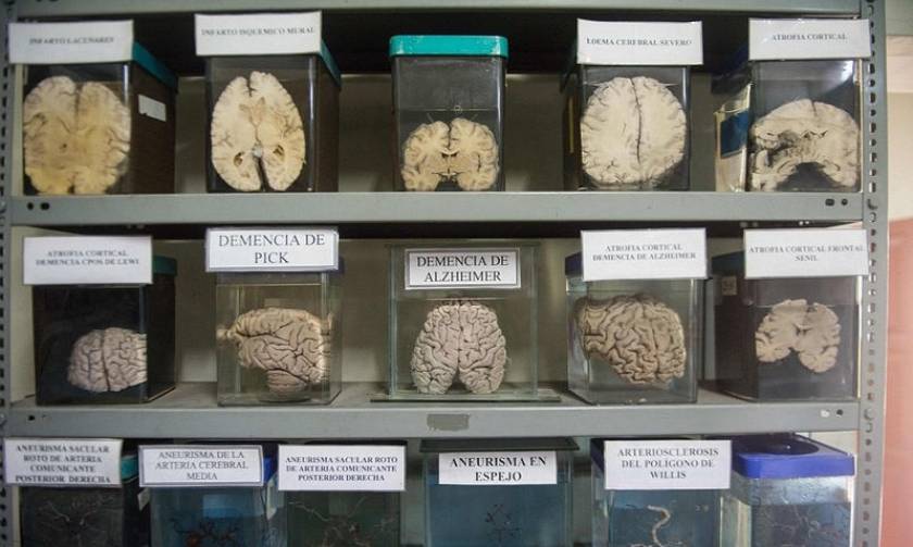 Φωτογραφίες από το μοναδικό μουσείο εγκεφάλων του Περού