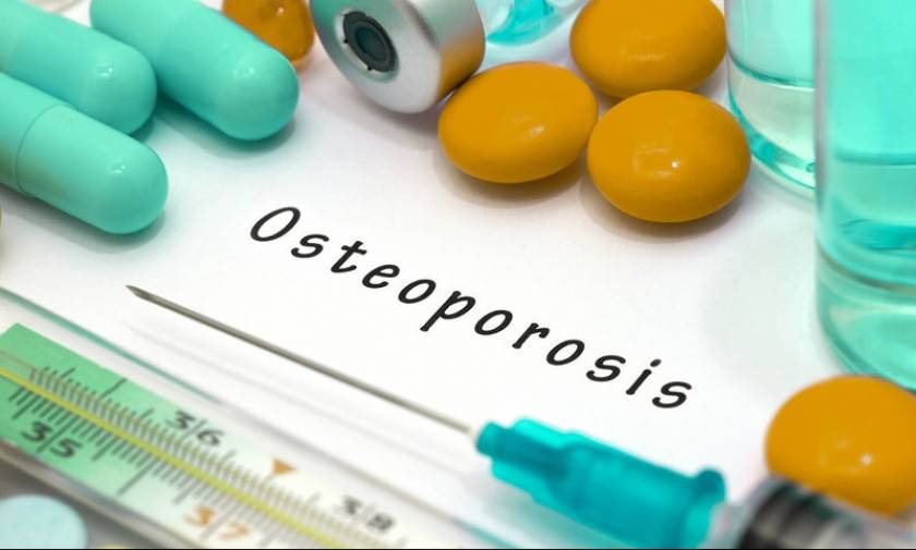 Οστεοπόρωση: Οι κακές συνήθειες που αυξάνουν τον κίνδυνο