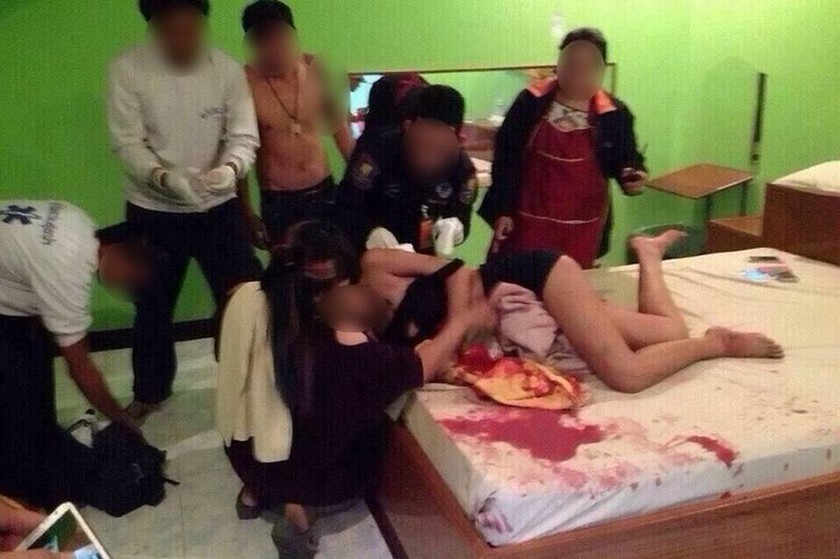 Φρικιαστικό ατύχημα: Έκαναν άγριο σεξ και «πνίγηκαν» στο αίμα! (ακατάλληλες εικόνες)