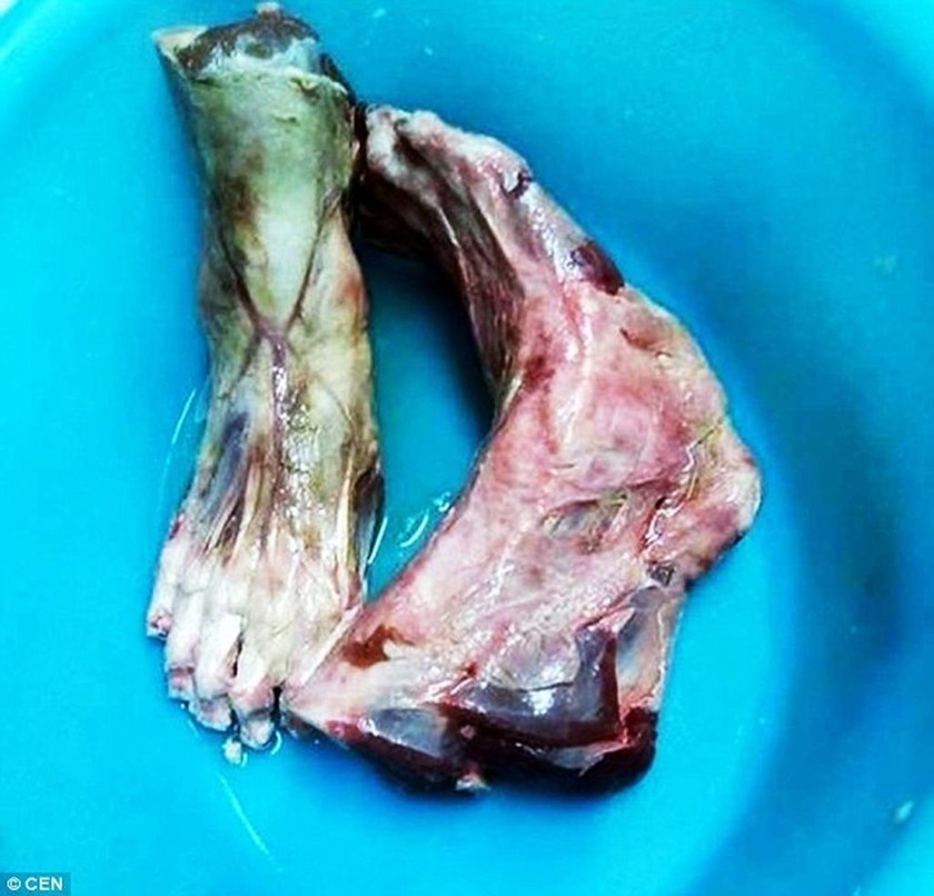 Φρίκη: Εστιατόριο σέρβιρε πιάτο με… ανθρώπινα πόδια (photos)