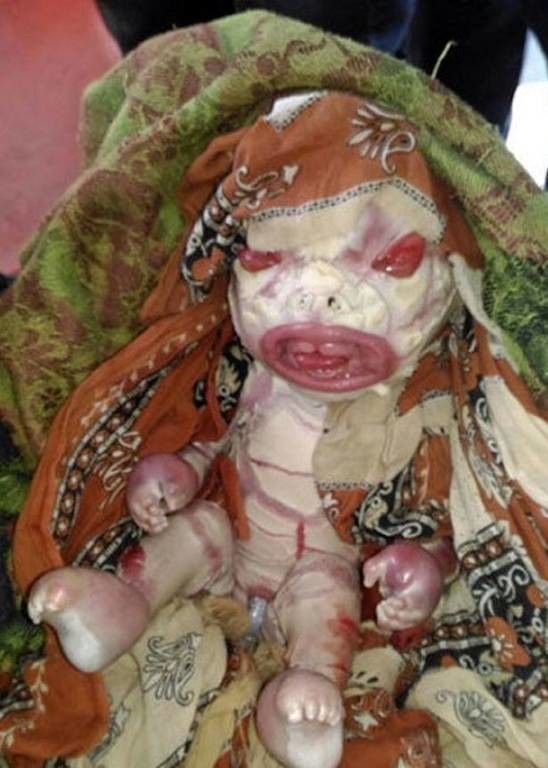 Σκληρές εικόνες: «Καταραμένη» μάνα γέννησε μωρό… τέρας και αρνείται να το ταΐσει (video+pics)