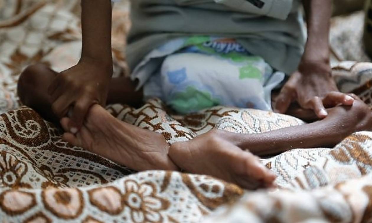 SOS από τον ΟΗΕ: Η Υεμένη κινδυνεύει να βυθιστεί στο λιμό