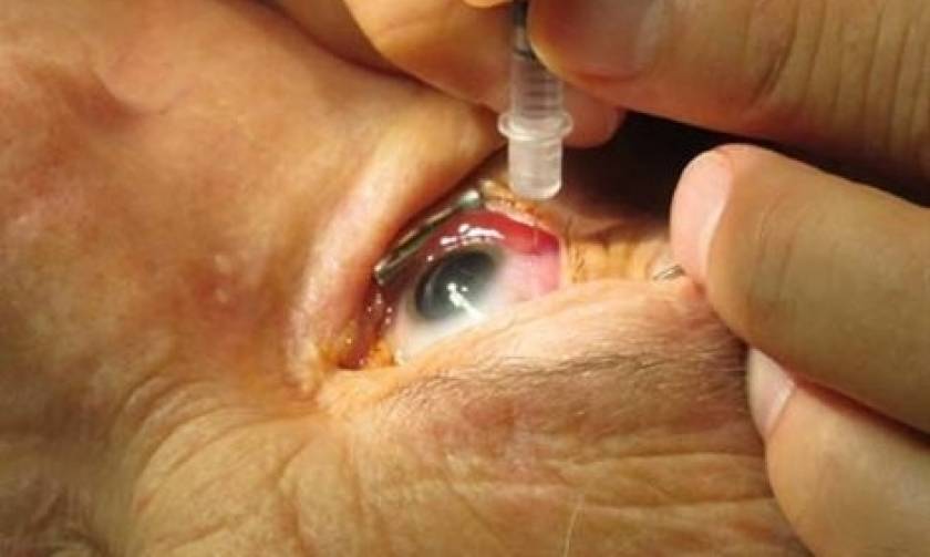 Τρεις γυναίκες τυφλώθηκαν από πειραματικές θεραπείες για τα μάτια
