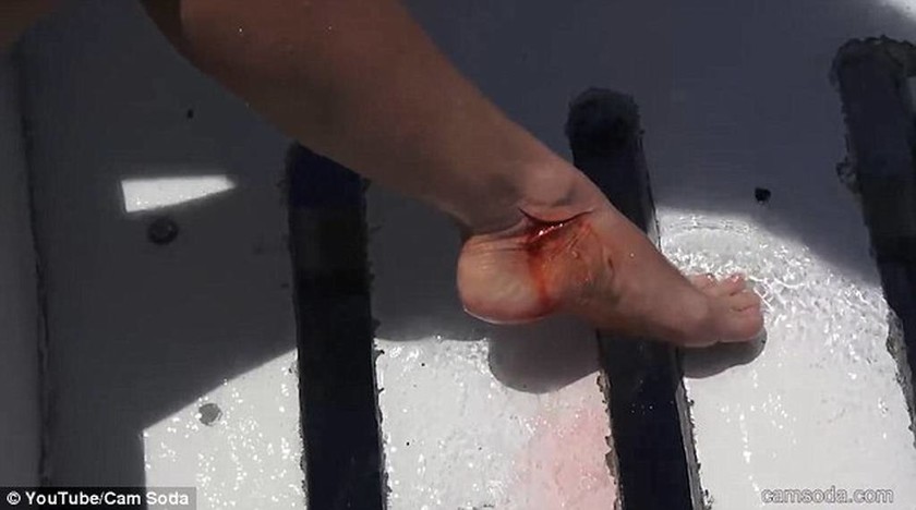 Τρόμος στη θάλασσα: Επίθεση καρχαρία σε γνωστή πορνοστάρ (pics+vid)