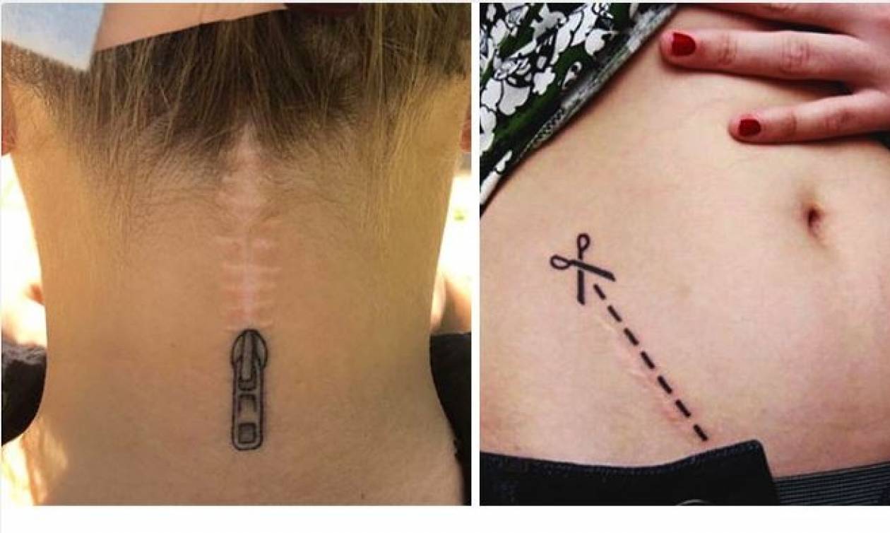 Viral: 30 εντυπωσιακά τατουάζ που μετέτρεψαν τις ουλές σε έργα τέχνης (Pics)