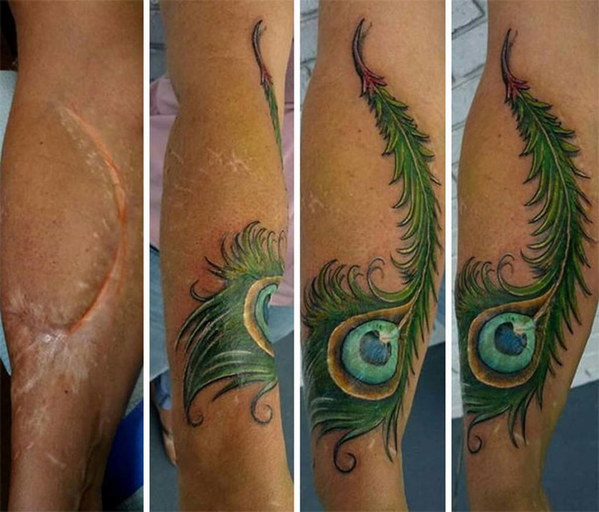 Viral: 30 εντυπωσιακά τατουάζ που μετατρέπουν τις ουλές σε έργα τέχνης