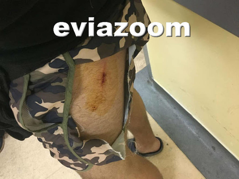 Απίστευτο περιστατικό στη Χαλκίδα: Του επιτέθηκε με σκαλιστήρι μετά από έντονη λογομαχία! (pics)
