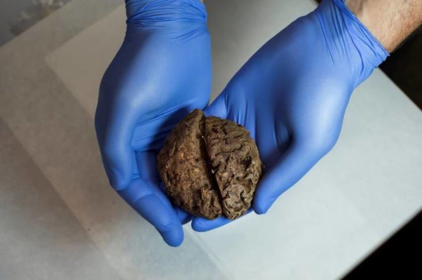 Απίθανη ανακάλυψη: Φυσικά διατηρημένοι εγκέφαλοι σε ομαδικό τάφο από τον ισπανικό εμφύλιο! (pics)