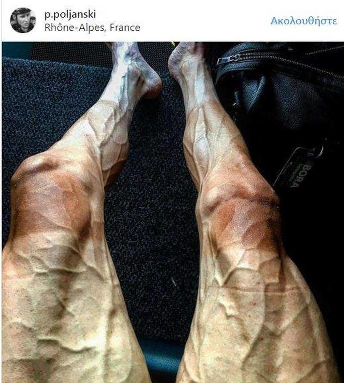 Σοκάρει η φωτογραφία από τα καταπονημένα πόδια ποδηλάτη λίγο μετά το γύρο της Γαλλίας
