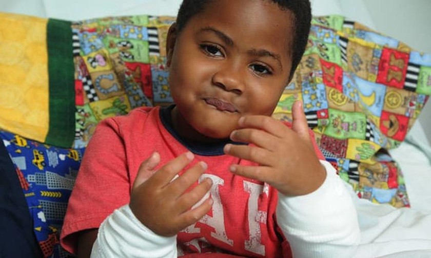 ΗΠΑ: Επιτυχής η πρώτη διπλή μεταμόσχευση χεριών σε 10χρονο (pics+vid)