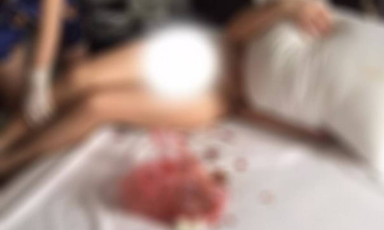 Φρίκη: Έτριψε καυτερές πιπεριές στα γεννητικά όργανα της ερωμένης του άνδρα της (photos)