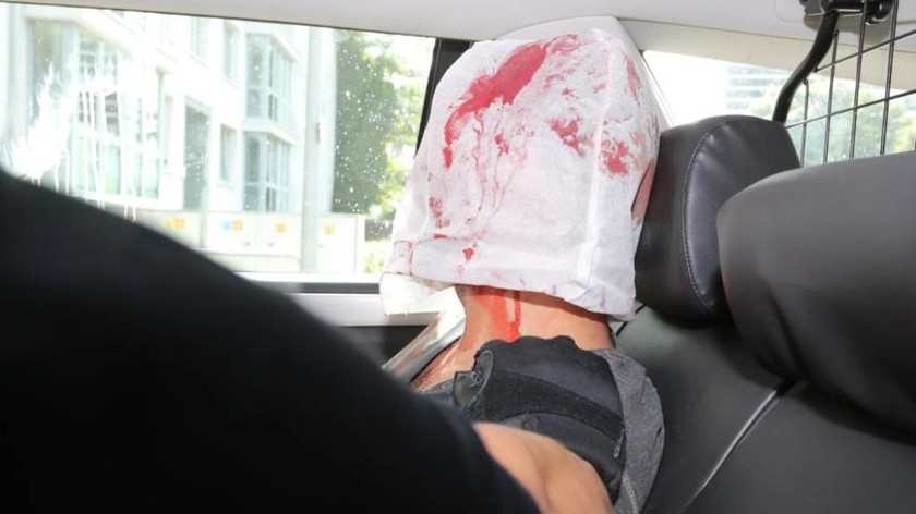 Αμβούργο: Αυτός είναι ο δράστης της επίθεσης με μαχαίρι σε σούπερ μάρκετ (pic)