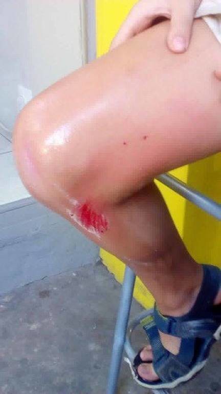 Πεζοδρόμιο-παγίδα για αγοράκι στη Λάρισα - Δείτε που σφήνωσε το πόδι του (pics)
