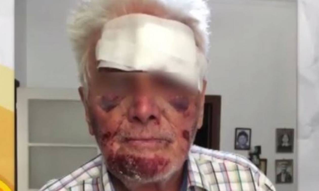 Φρίκη για 90χρονο στο Γαλάτσι: Τον ξυλοκόπησαν και τον μαχαίρωσαν για 5 ευρώ (vid)