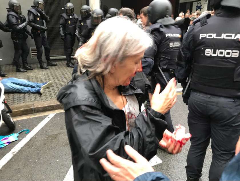 Καταλονία: Πνίγηκε στο αίμα το δημοψήφισμα – Πρωτόγνωρες σκηνές αστυνομικής βίας με 761 τραυματίες