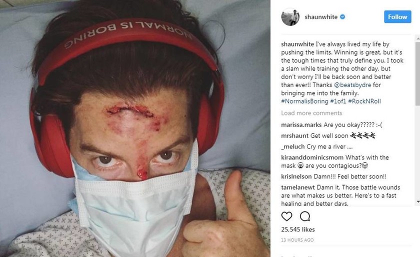 Ολυμπιονίκης κατέληξε στο νοσοκομείο μετά από ατύχημα στην προπόνηση (pic)