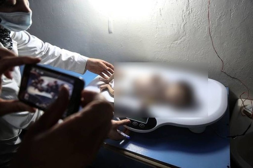 Σοκάρουν οι εικόνες από τη Συρία με σκελετωμένα παιδιά να πεθαίνουν από την πείνα