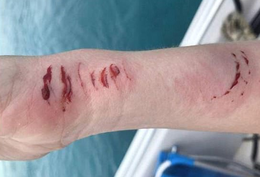 Προσοχή σκληρές εικόνες : Καρχαρίας επιτίθεται σε νεόνυμφη στο ταξίδι του μέλιτος (vid)
