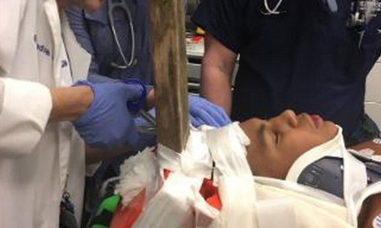 Σοκαριστικό ατύχημα: Βίδα καρφώθηκε στο κεφάλι 13χρονου (ΣΚΛΗΡΕΣ ΕΙΚΟΝΕΣ)