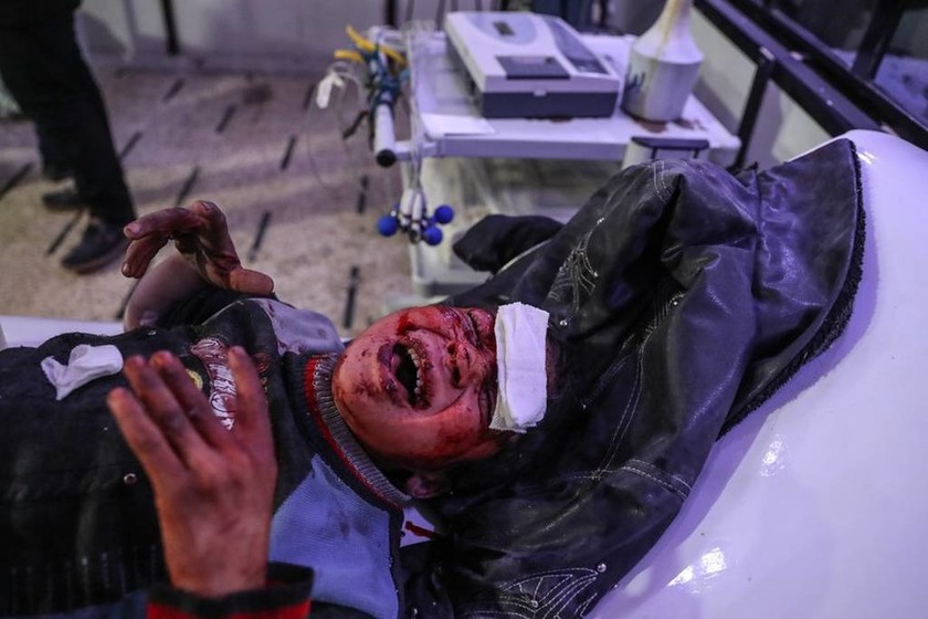 «Λουτρό αίματος» στη Συρία: 250 άμαχοι νεκροί μέσα σε 48 ώρες (ΠΡΟΣΟΧΗ! ΣΛΗΡΕΣ ΕΙΚΟΝΕΣ)
