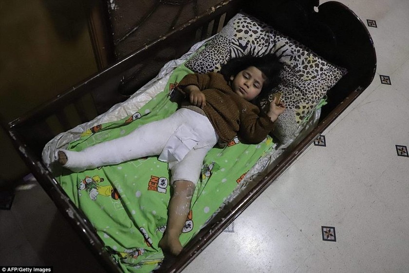 Φωτιά και αίμα: Συγκλονιστικές φωτογραφίες από τον ανηλεή βομβαρδισμό της Γούτα (ΣΚΛΗΡΕΣ ΕΙΚΟΝΕΣ)