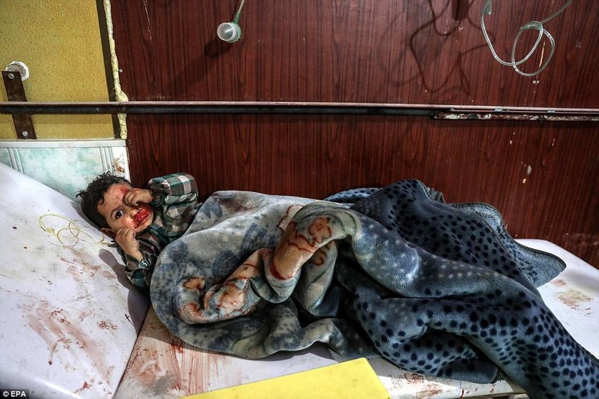 «Λουτρό αίματος» στη Συρία: Τουλάχιστον 1.220 άμαχοι νεκροί σε ένα μήνα στη Γούτα (ΣΚΛΗΡΕΣ ΕΙΚΟΝΕΣ)