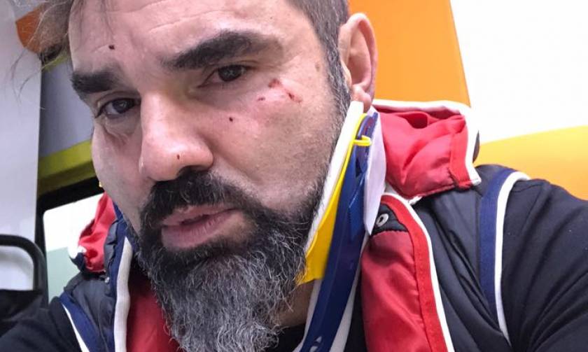 Θύμα δολοφονικής επίθεσης ο Νάσος Γουμενίδης (video+pics)