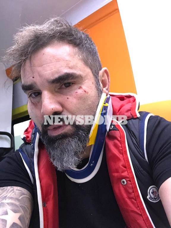 Εκτακτο: Θύμα δολοφονικής επίθεσης ο Νάσος Γουμενίδης (video+pics)